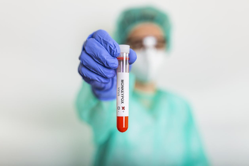 Latest company news about هل يسلك Monkey-pox طريق Covid-19؟