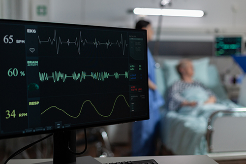 أحدث مدونات الشركة حول فهم التشنج الأذيني (AFib)