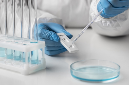 Latest company news about فوائد وعيوب اختبار مستضد COVID-19 في المنزل