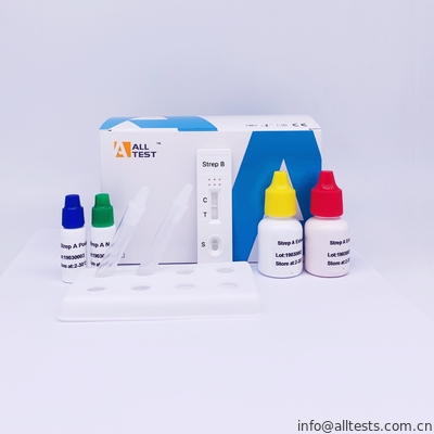 Good price اختبار Strep السريع للكشف النوعي عن العقدية للمجموعة ب (GBS) في البول الانترنت